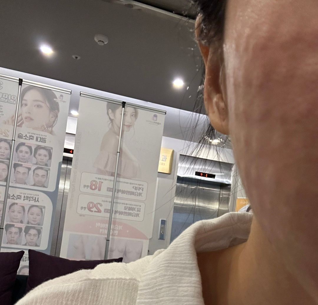 손기술 좋은 원장님 덕에 리쥬란 여기로 완전 정착했어요ㅎㅎ
