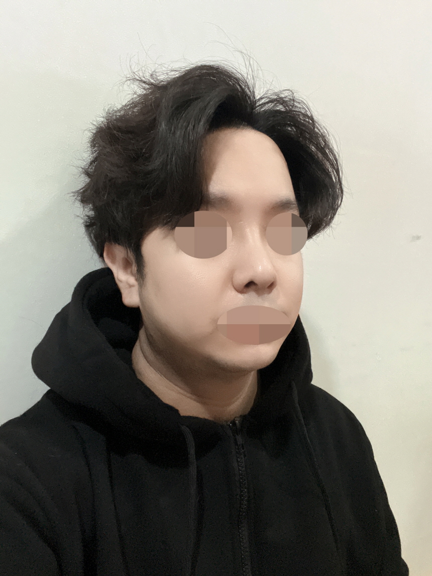 통증도 적고 변해가는 과정 보는게 즐겁습니다