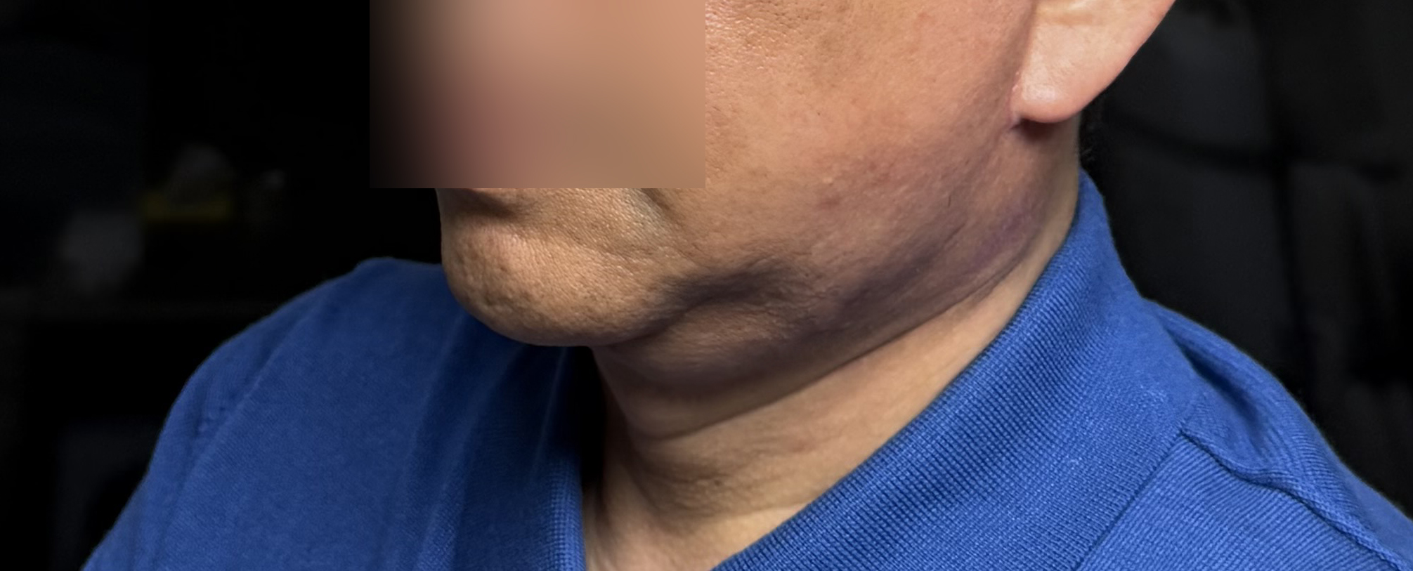 목거상 2달차, 일상생활 불편함 없이 지내는 후기