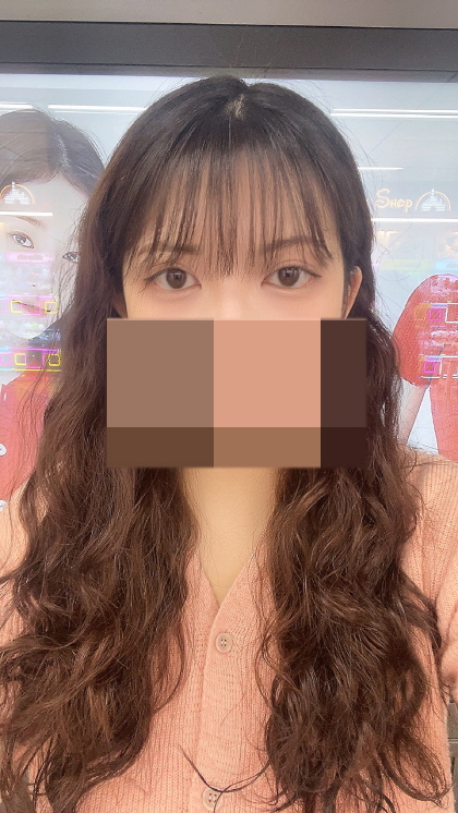 쌍커풀이 잘 풀리는 거 같아 걱정했는데 라인이 아직 선명하고 좋습니다~