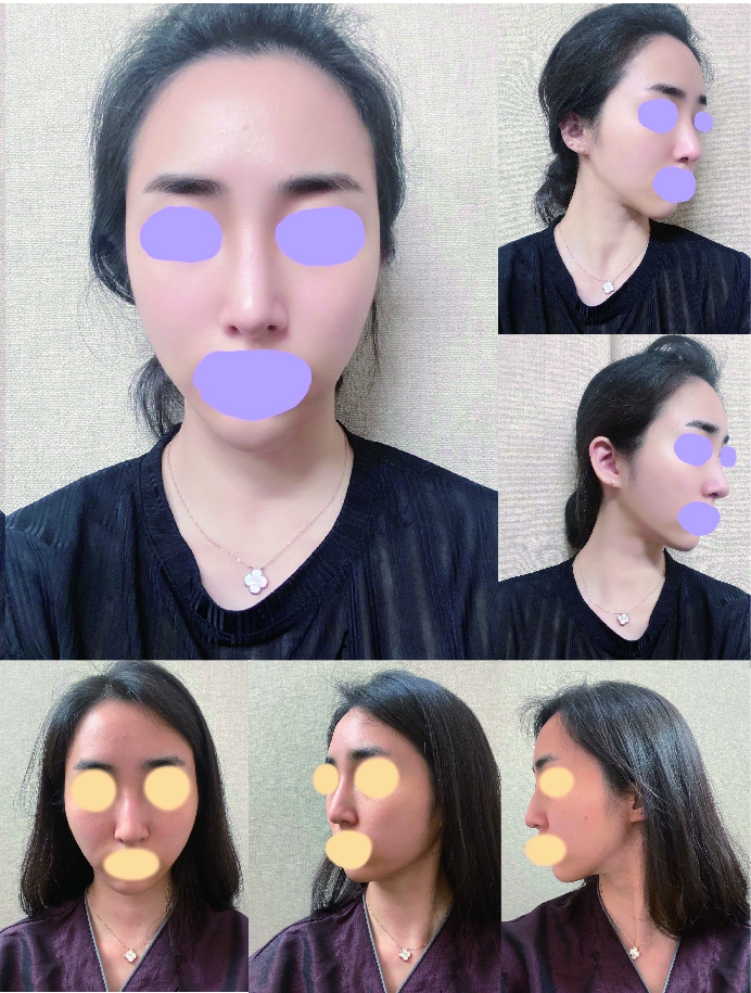 코 2달차 후기입니당