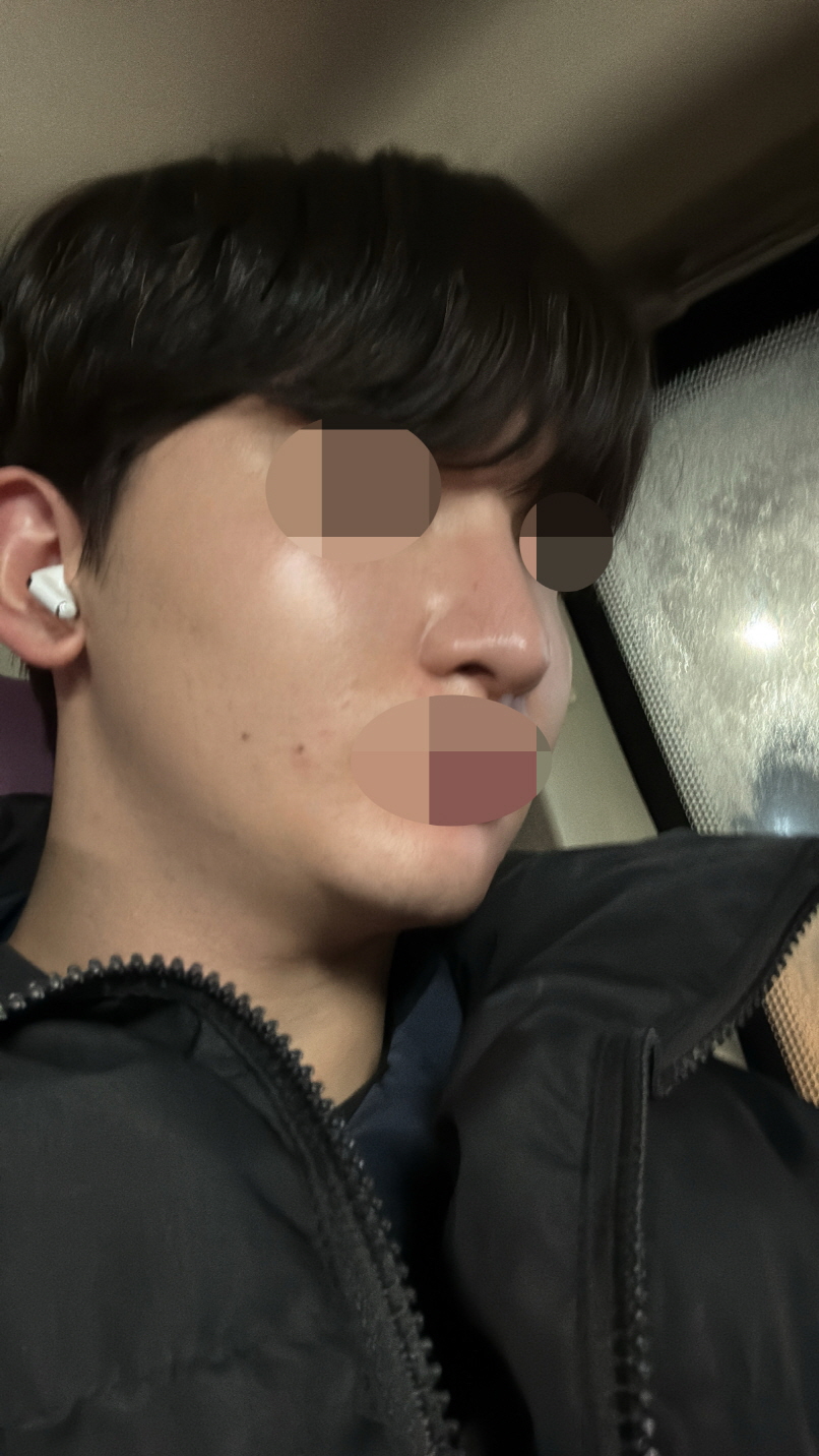 주변에서 칭찬도 많이하고 병원도 많이 물어봐요!! 너무 만족스러운 제2의 인생 삽니다!!