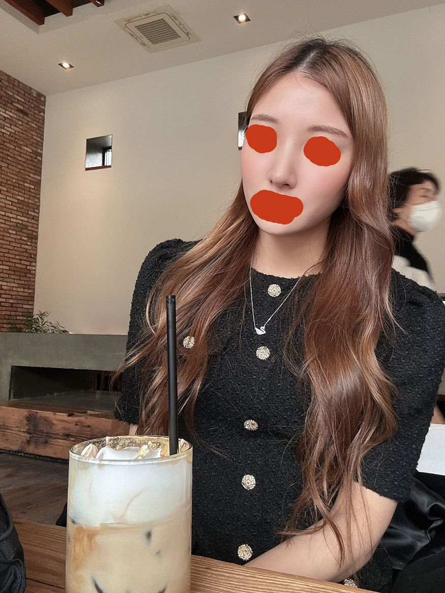 수술 한달차인데 너무 만족스럽습니다,,,!