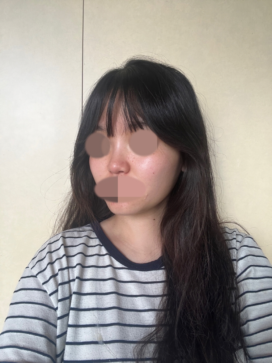 옛날 사진과 비교하면 분위기가 달라서 좋네요