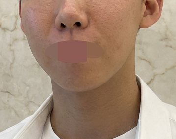 여름 지나고 피부 푸석해진 것 같아서 리투오 받으러 방문했습니다