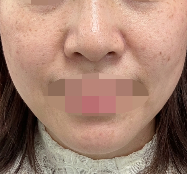 일본어 가능하고 위치도 좋아서 불편함 없었습니다. 한국인 단골도 많고 오래된 곳이라 믿음이 가요~