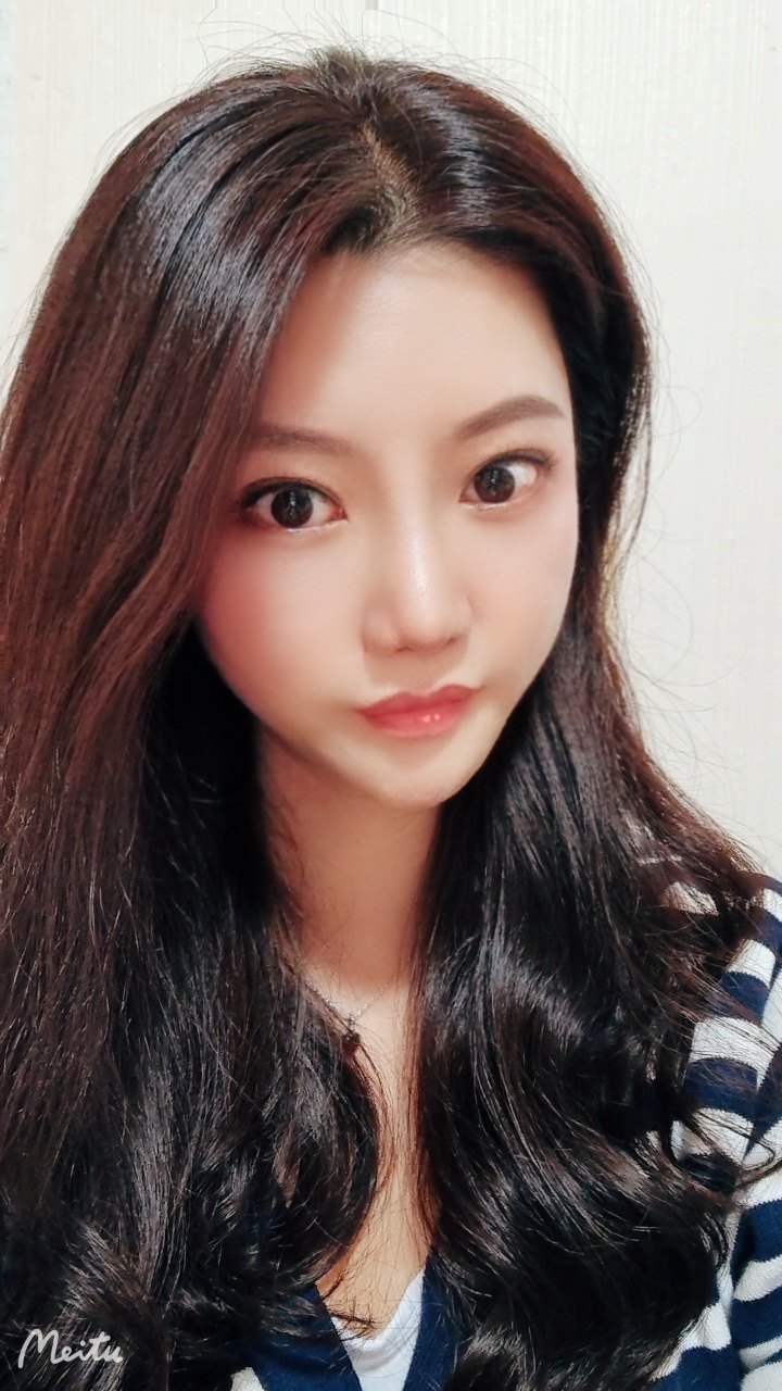코 재수술 3개월 후기~감사드려용