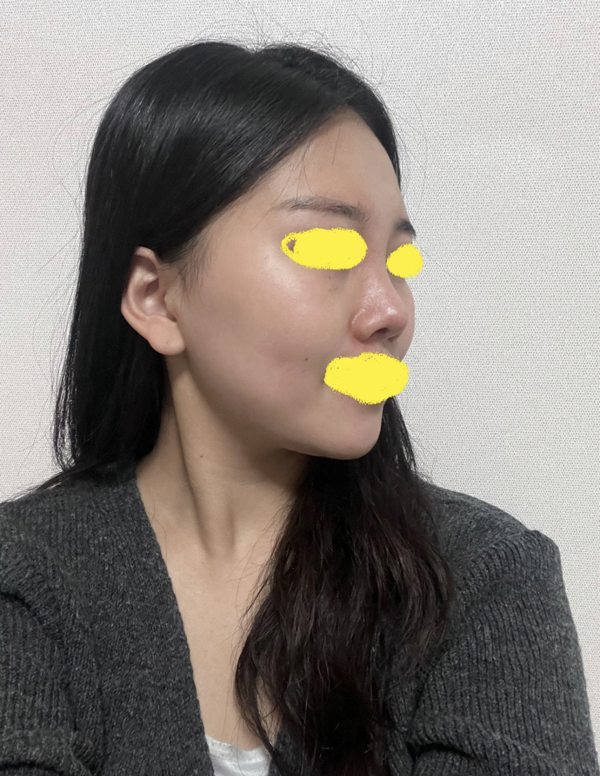 황원장님께서 제 얼굴에 맞게 자연스럽게 해주신 것 같아요 ㅎㅎ