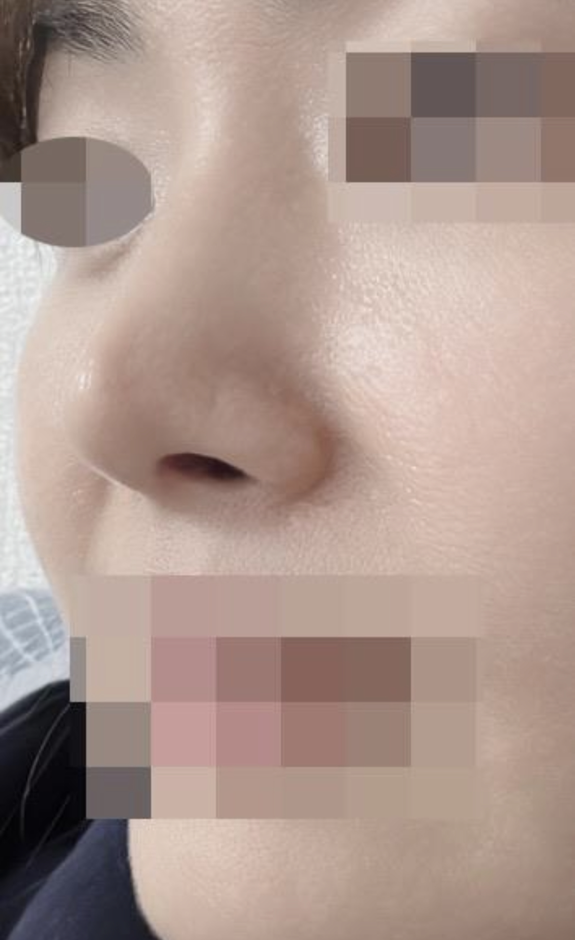 주변에서 자연스럽게 잘 되었다고 이쁘다고 하네요 ㅎㅎ