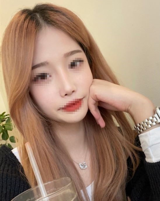 수술 세달차입니당!