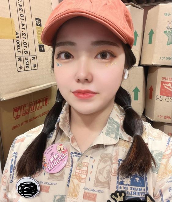 얼굴 지방흡입 두번째 후기(두달차)