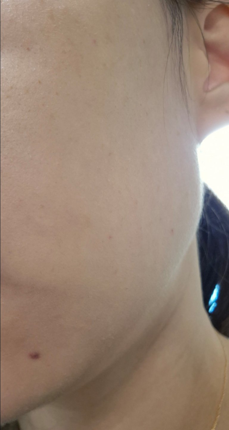 30대 중반부터 관리 시작했는데 피부 좋아져서 꾸준히 받으려고요!
