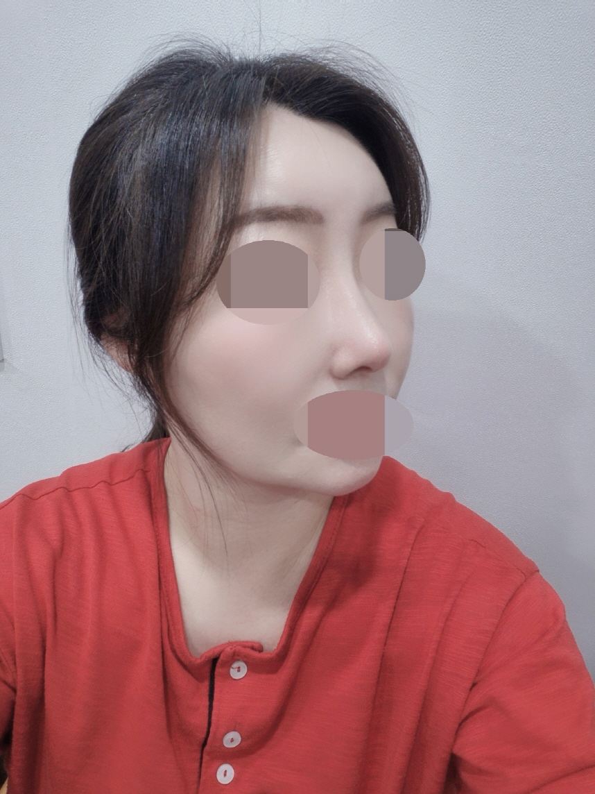 주변에서도 너무 잘됐다고 부러워해요 대만족입니다