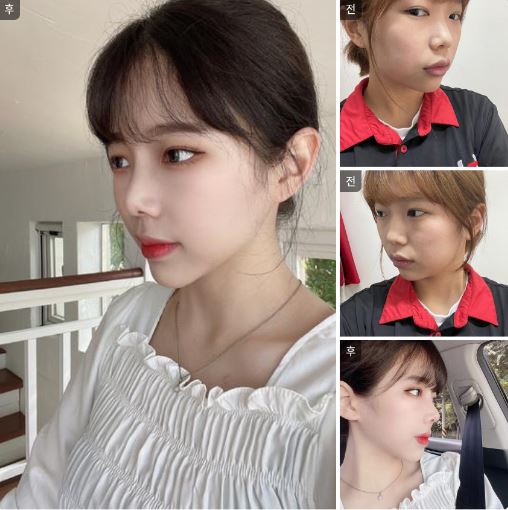 코 한달차 후기✌
