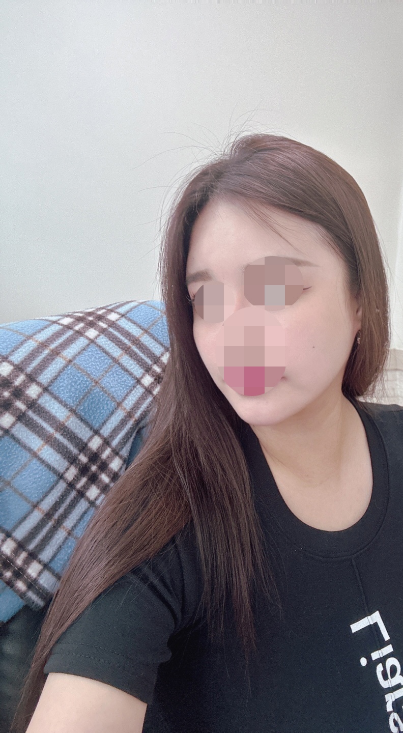 심술 가득하고 넙대대했던 얼굴이 많이 개선되서 정말 만족합니당ᄒᄒ