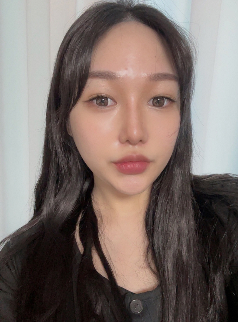 *서울아이 코 3개월차 후기*