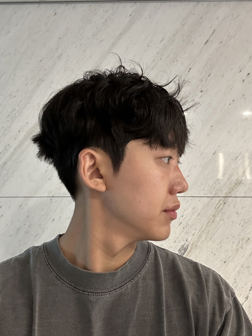 수술후 자연스럽게 잘 된거같아 만족합니다~