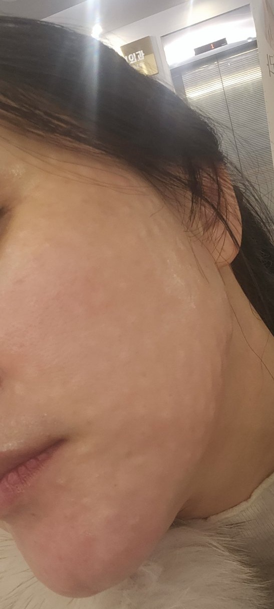 겨울 건조함 때문에 받았는데 촘촘하게 잘 해주셔서 굿ㅎㅎ