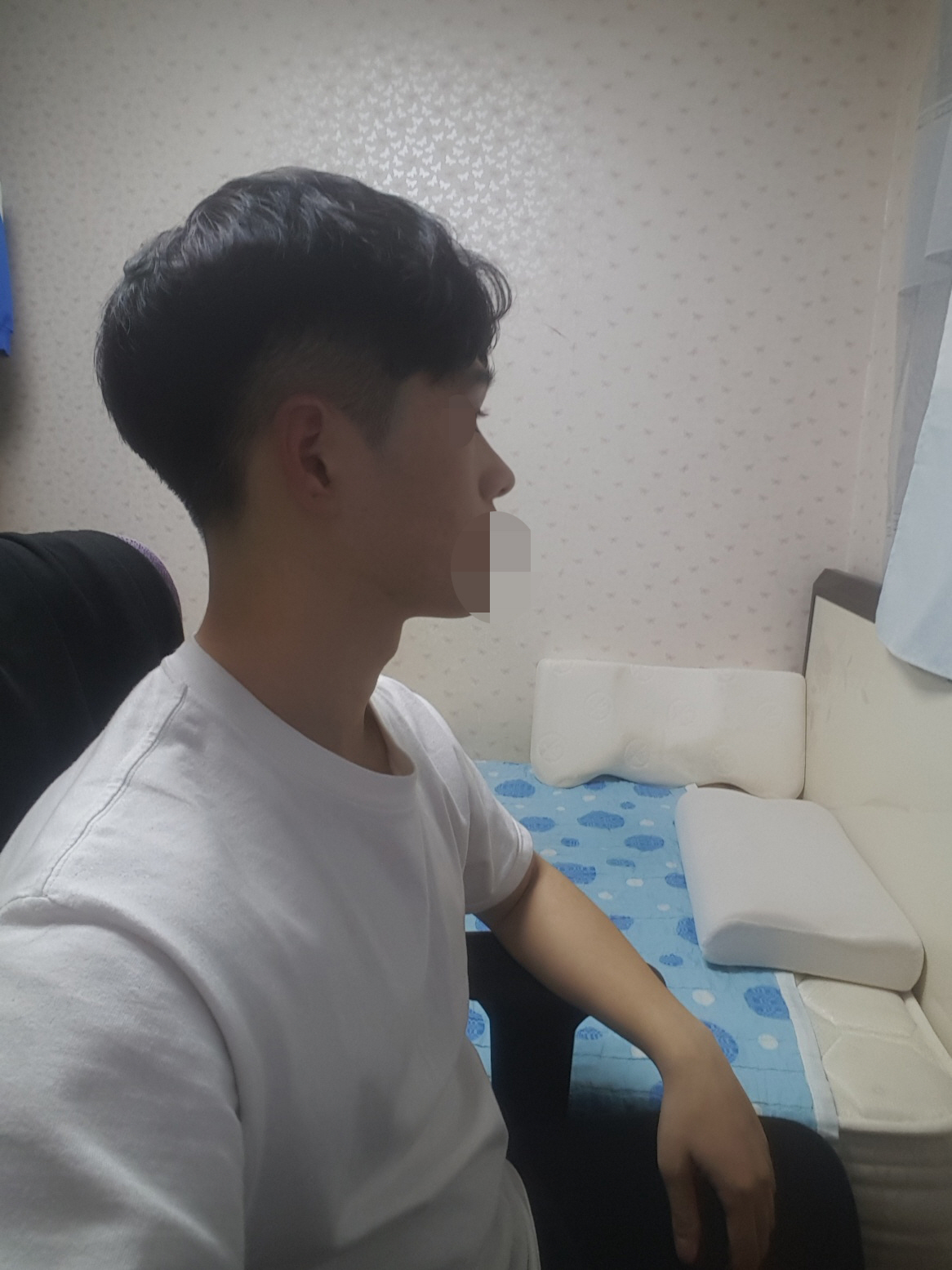 이제는 아무 통증도 없고 친구들이랑 만나면 코도 많이 높아진게 체감이 되서 정말 좋아요. 황원장님 감사합니다!