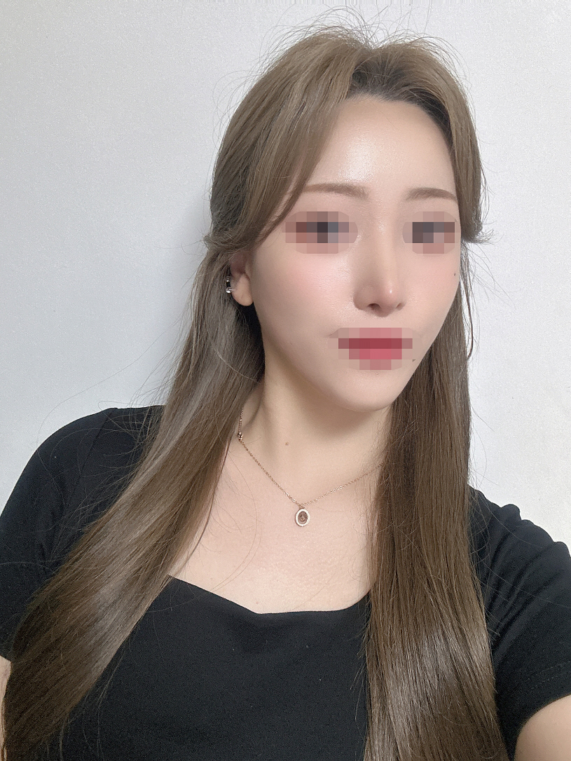 하루하루 자신감있게 사는중이에요! 원장님 너무너무 만족합니당!