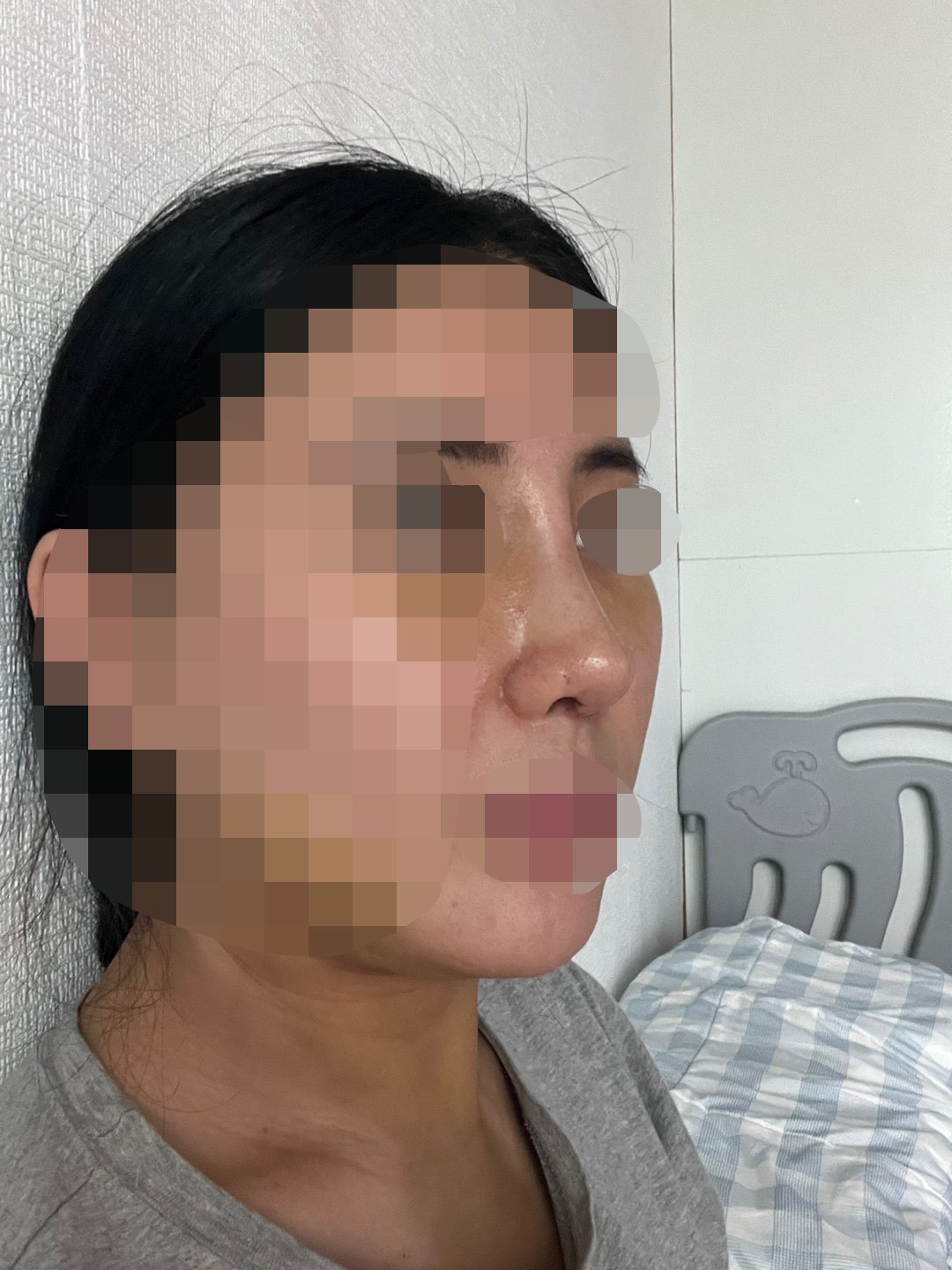 원장님 자세히 설명해 주시는거에 믿음이 갔어요~