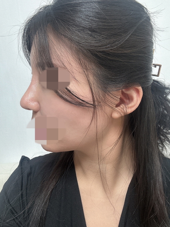 3주 지나면서 많이 좋아졌어요