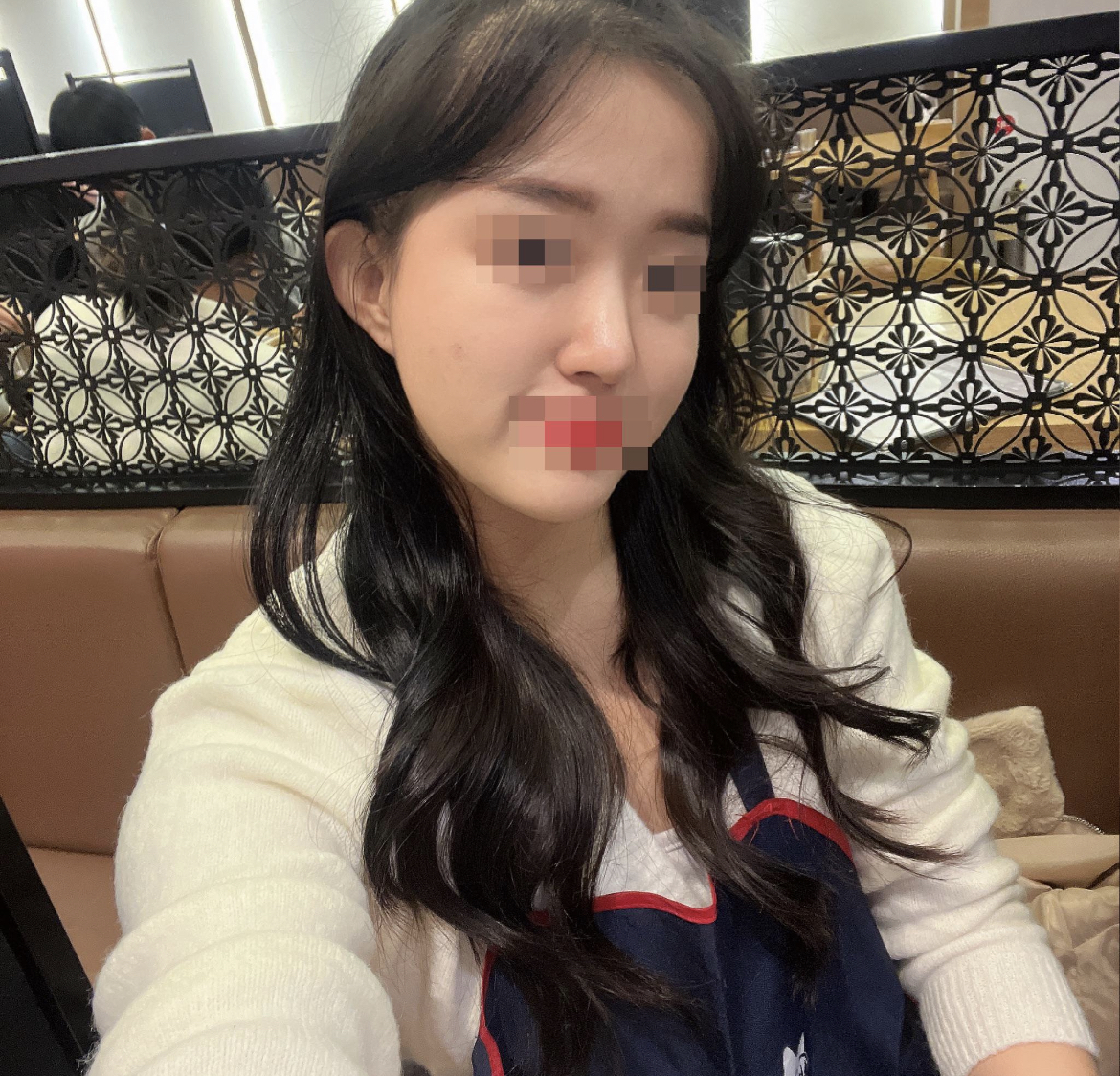 제가 가장 원했던 자연스럽지만 라인이 깔끔하게 보이도록 수술 너무 잘됐어요