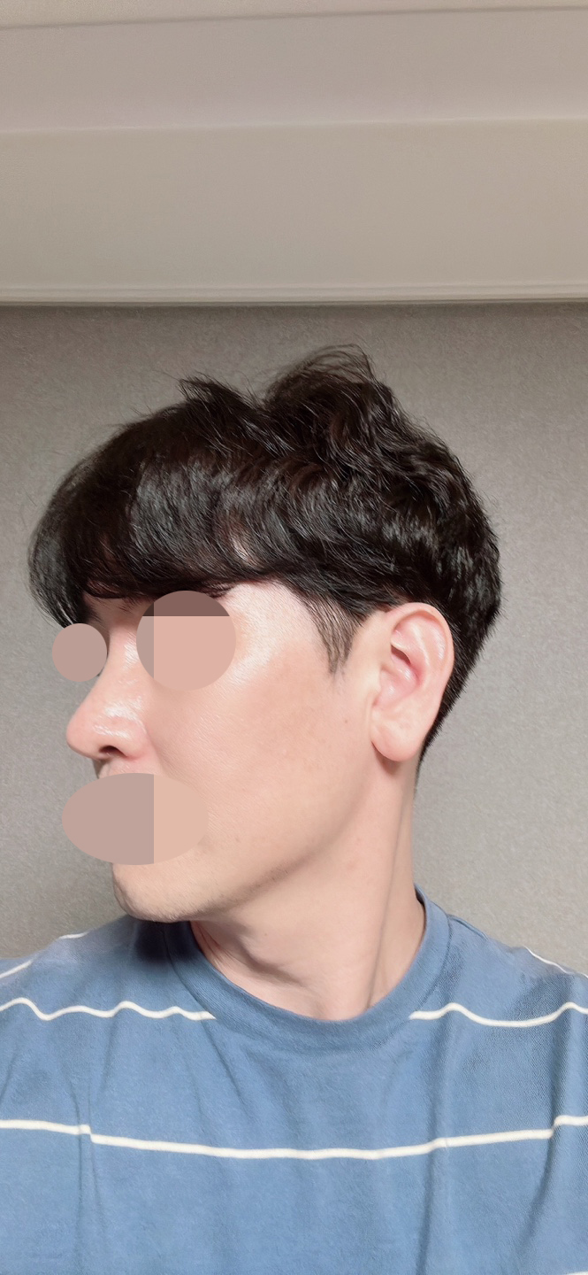 코 너무 잘 됐습니다~!