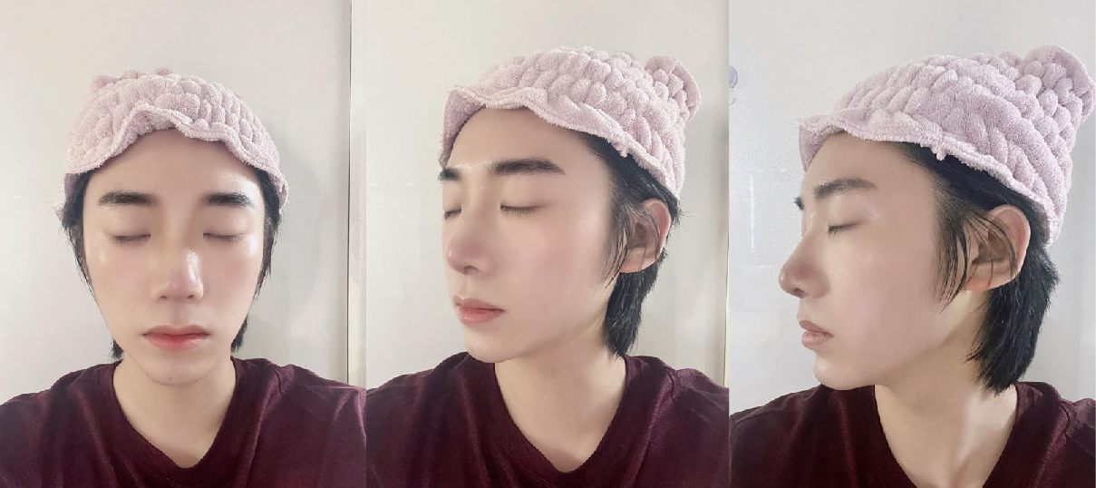 남자 코 후기!