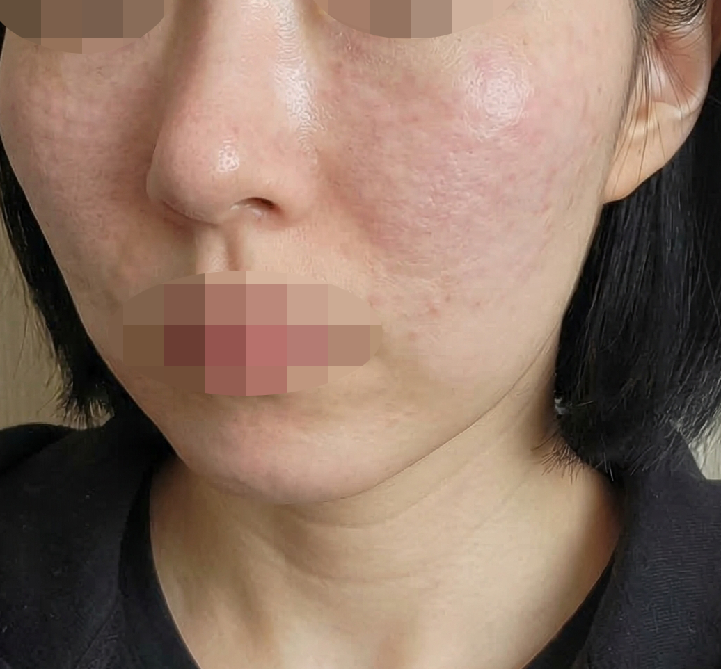 과잉 권유 없이 꼼꼼하게 해주셔서 좋았어요!!