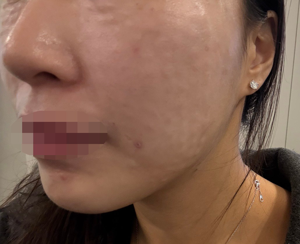 안 아프게 잘 놔주셔서 완전 강추!!
