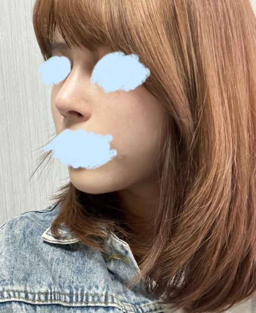콧대, 코끝후기 입니당
