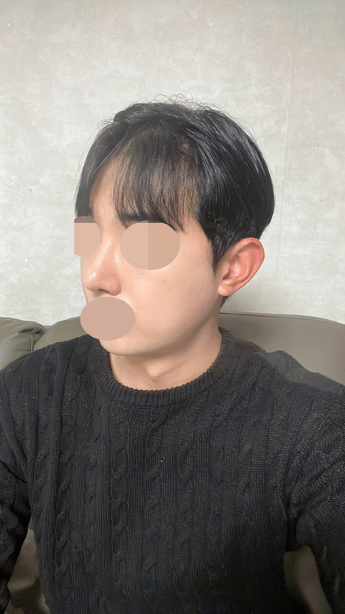 코가 자리가 잡혀 자연스럽고 숨쉴때도 편해서 굉장히 좋습니다