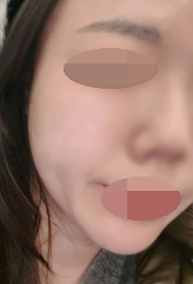 리쥬란 맛집이라 벌써 5회째 다니고 있어요 ㅎㅎ