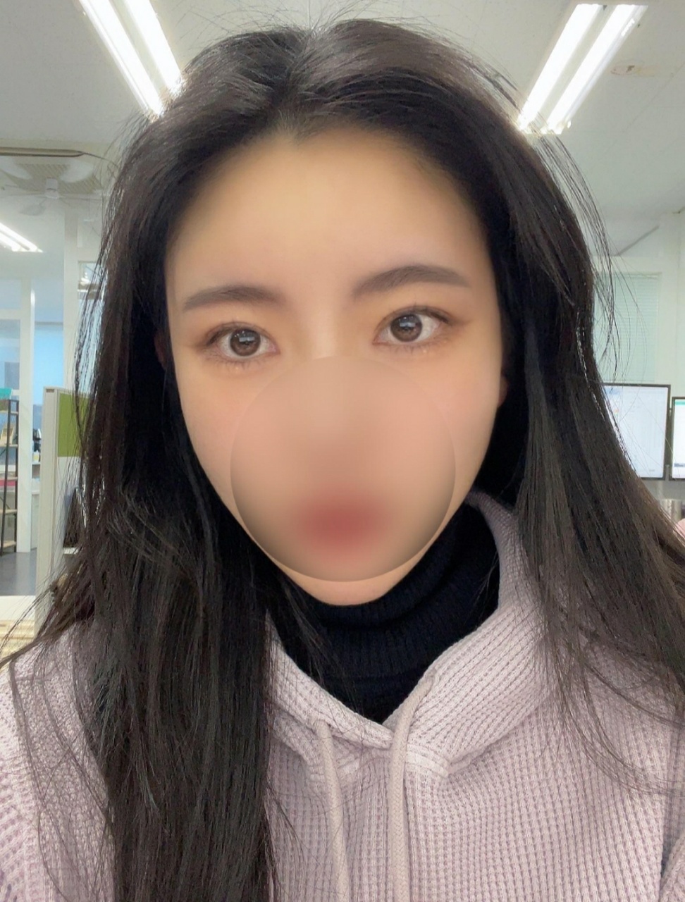 쌍커풀 2달 후기입니당