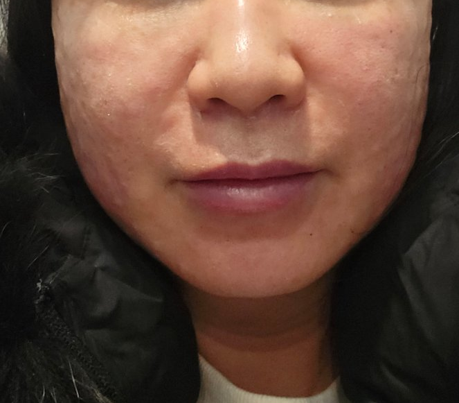 예약대로 진행되고 편해서 꾸준히 다녀보려고요~