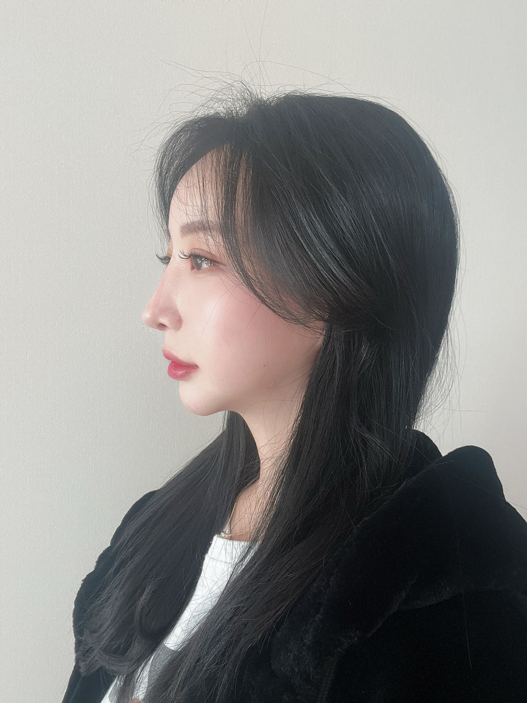 눈,코 둘다 너무 세련되졌고 맘에들어요☺