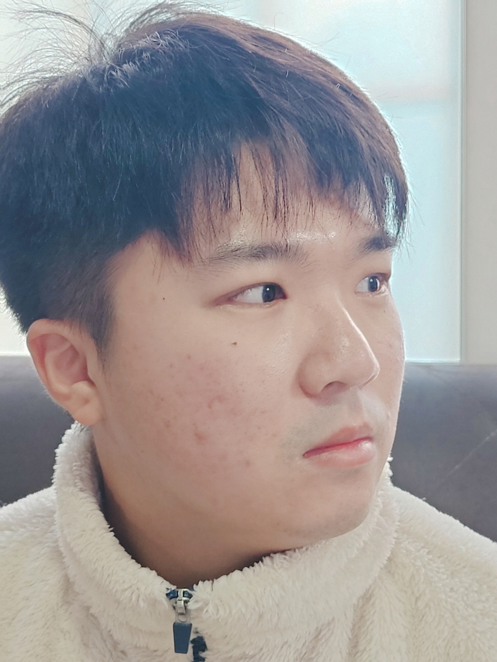 지인에게 소개받고 수술 했는데 너무 잘 돼서 다행이예요 :)