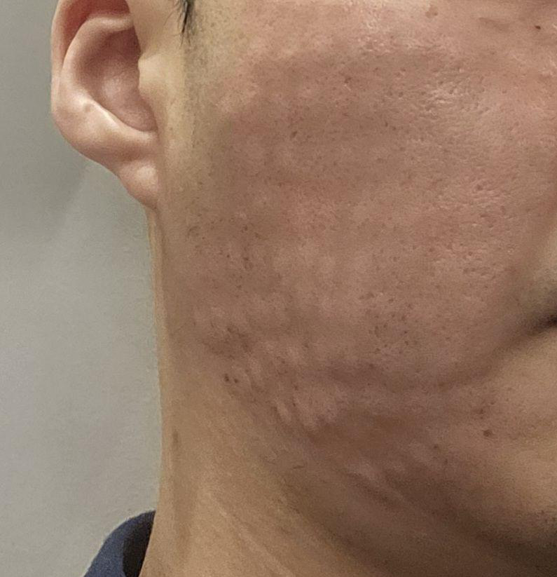 결과 만족스러워서 정기적으로 방문 중입니다.