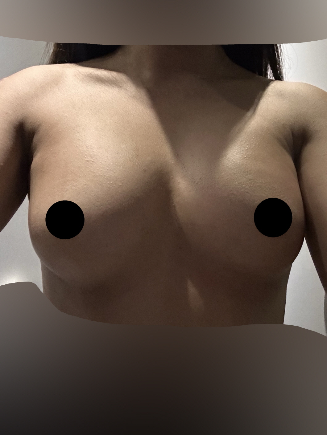 양쪽 가슴이 너무 자연스럽게 맞춰져서 너무 신기하고 만족스러워용!!!
