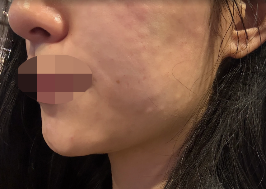 깔끔한 시설에 꼼꼼한 안내까지, 강남언니로 예약하길 잘했어요~><