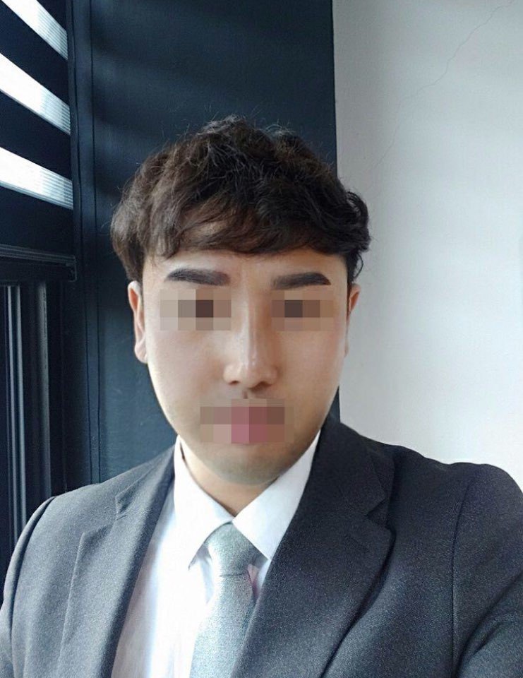 코수술 한달째입니다~!