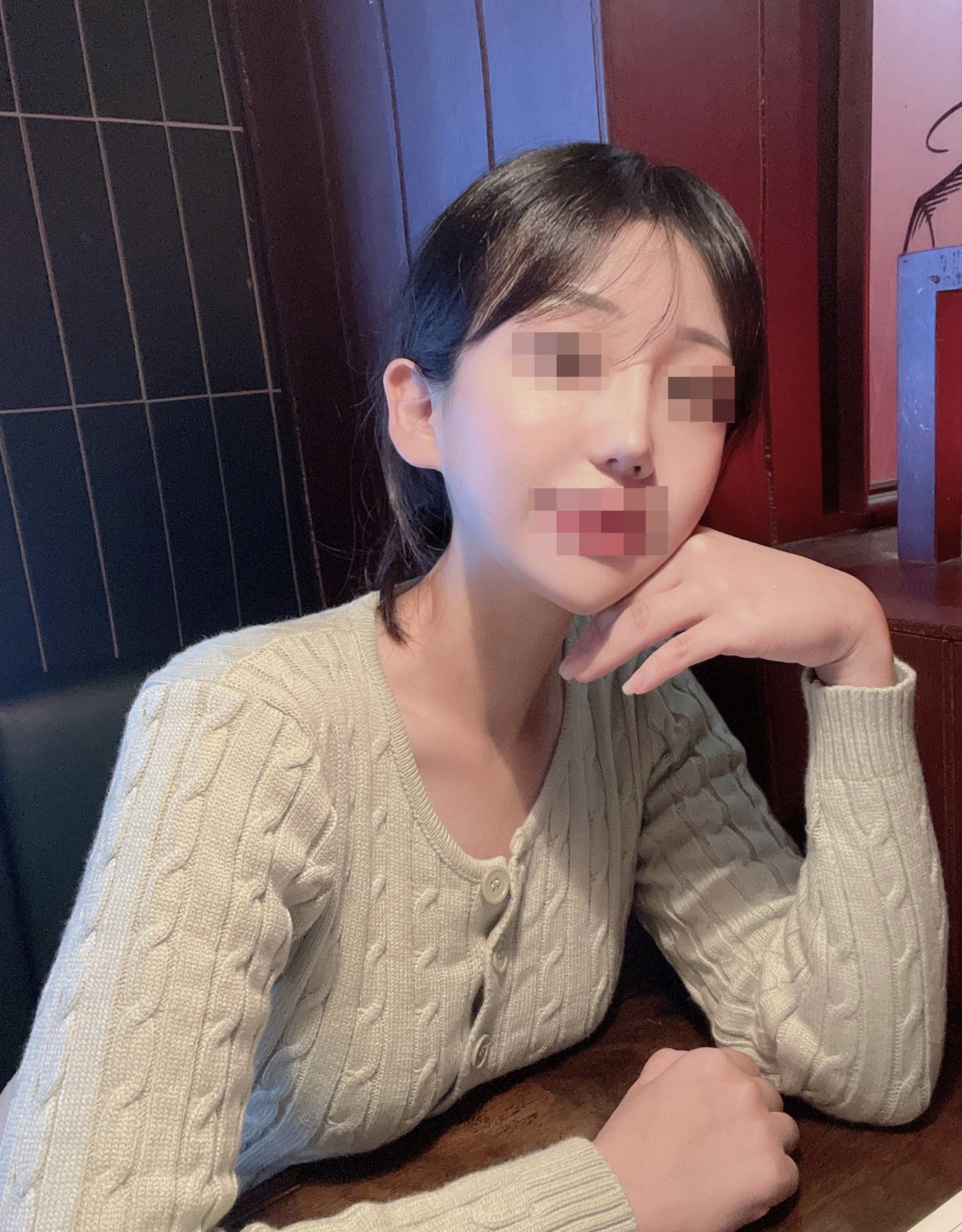 2주차인데 붓기도 빨리 빠지구 넘넘 만족스러워요!