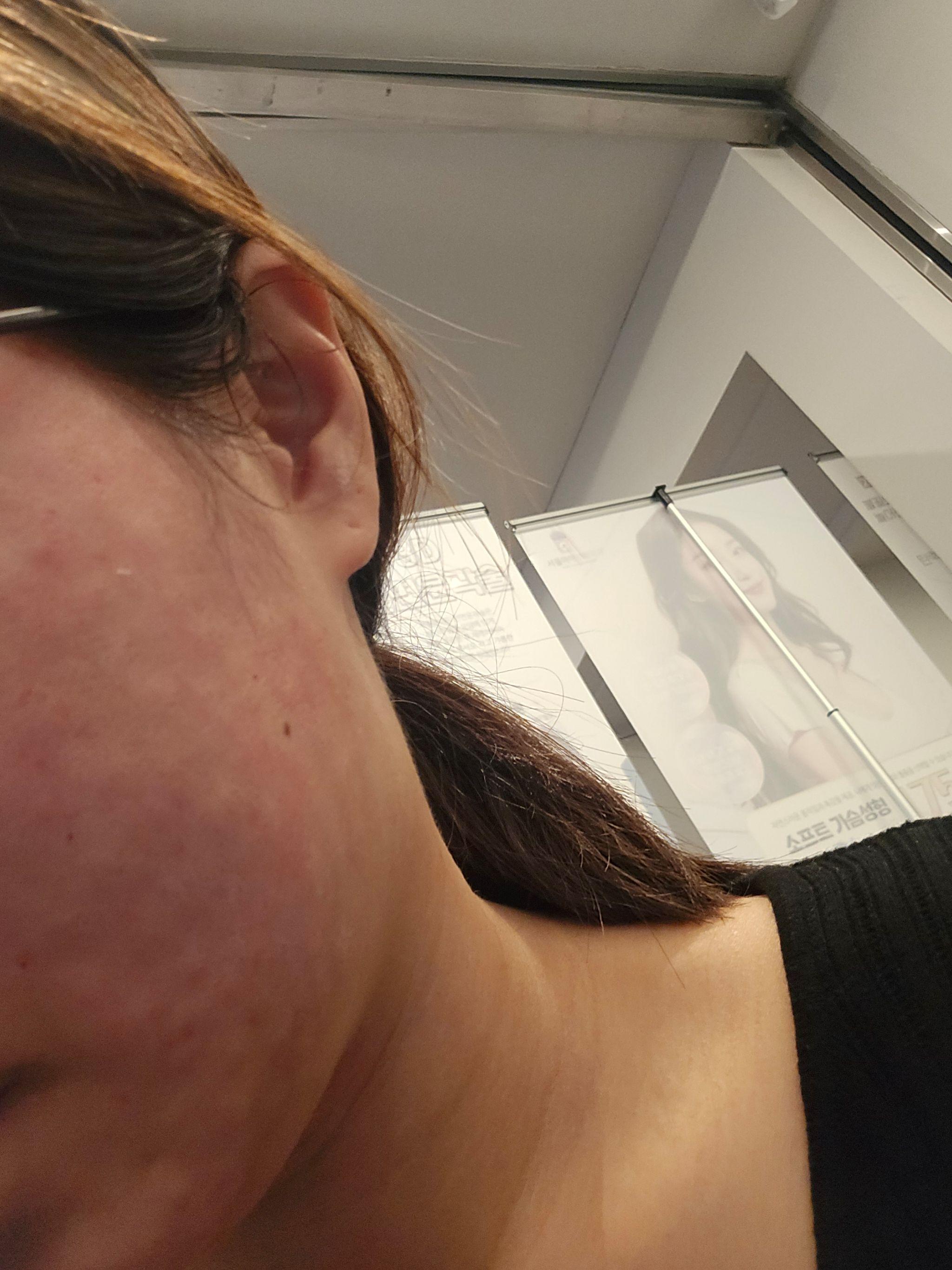 친절하고 꼼꼼한 슈링크, 여기서 계속 받고 있어요~