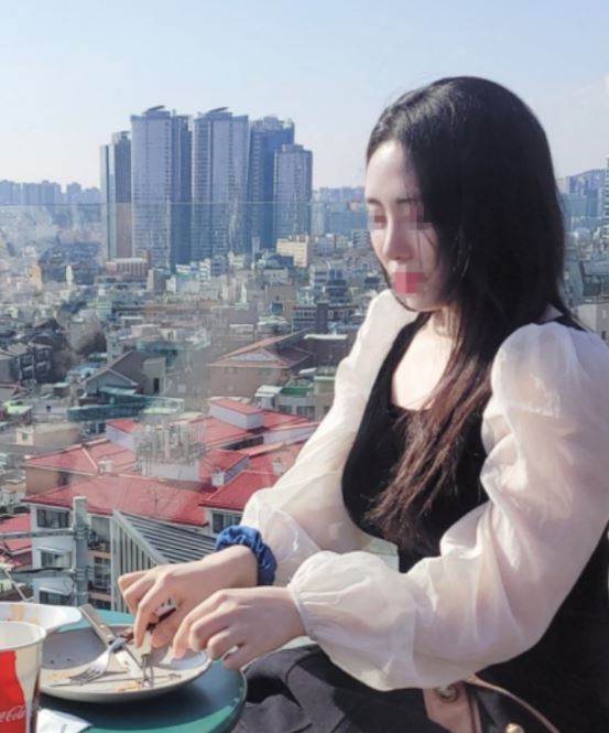 휜코교정+매부리코 교정+복코교정+코끝 찐후기!!