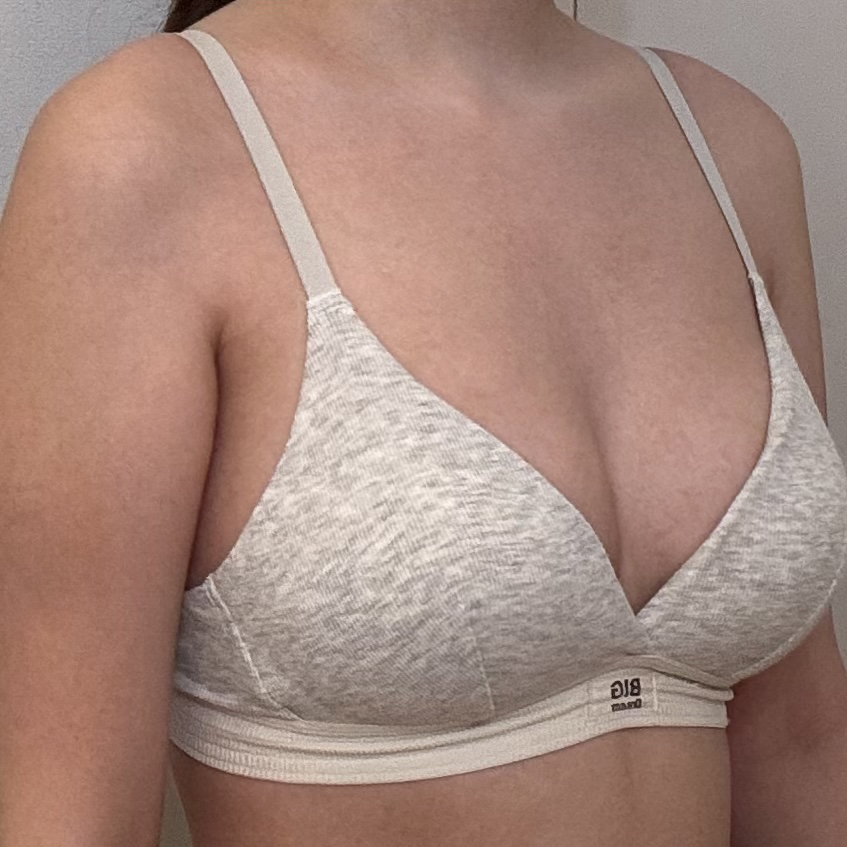 보형물이지만 부자연스럽지 않게 예쁘게 잘됐어요~