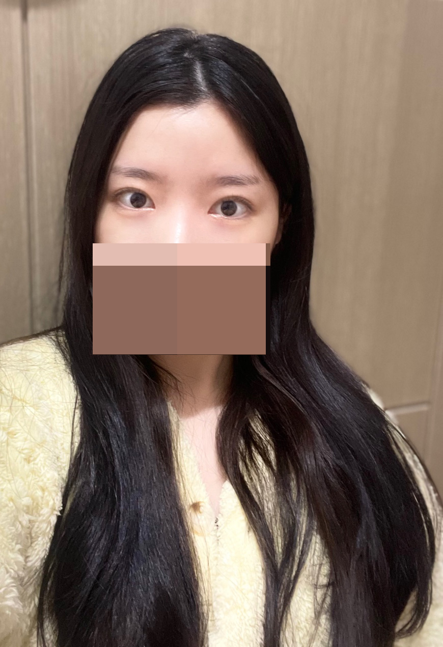 붓기 잘빠지고 있고 만족스러워용