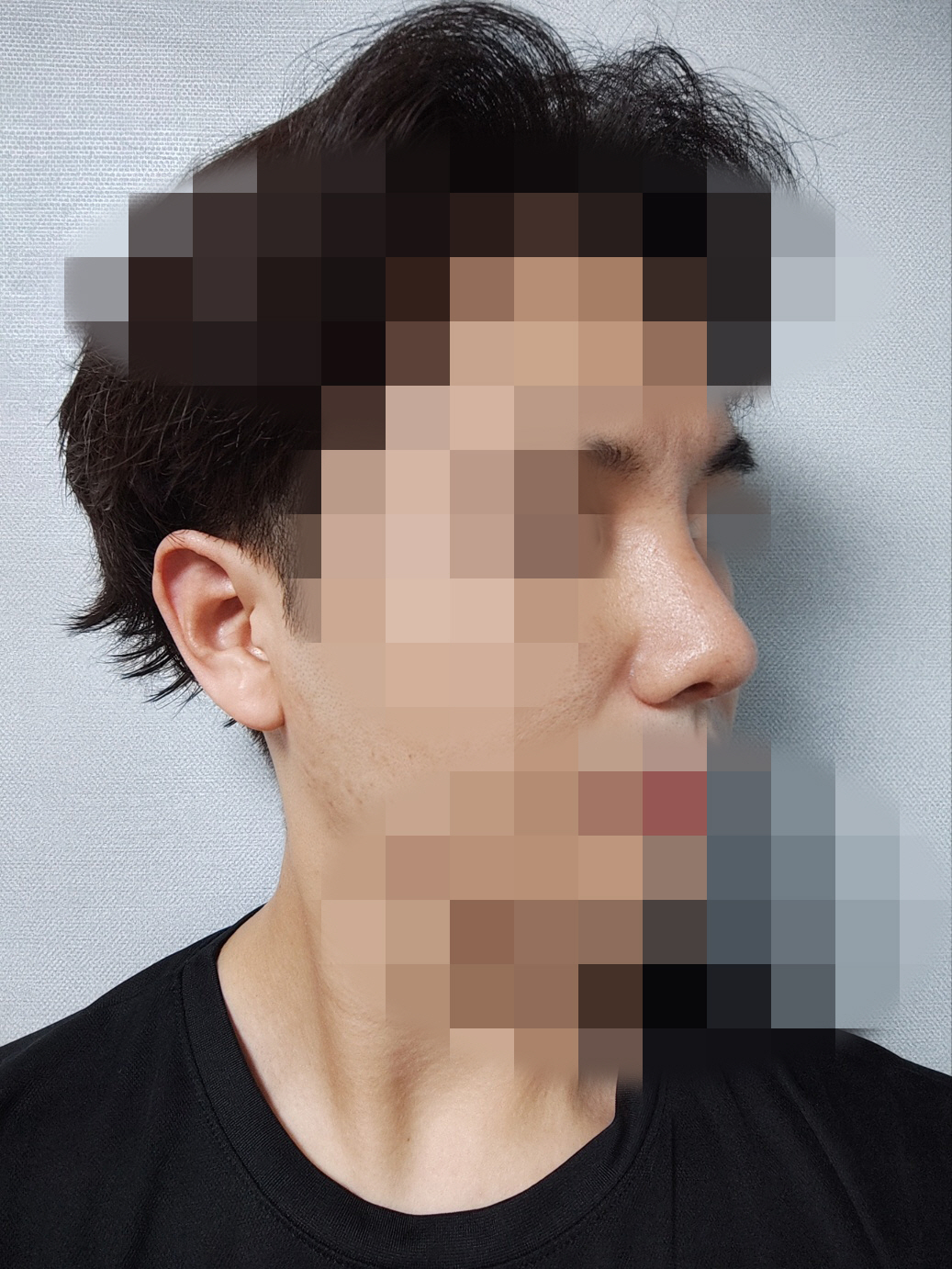 결과적으로 서울아이 황정일 원장님 선택했고 잘 된 것 같습니다.