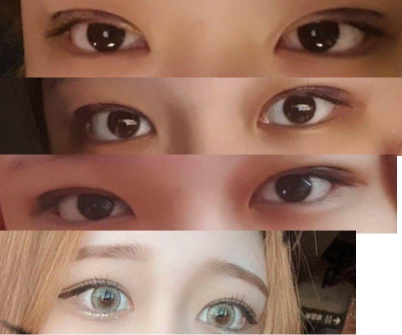 황원장님께 쌍수했어여