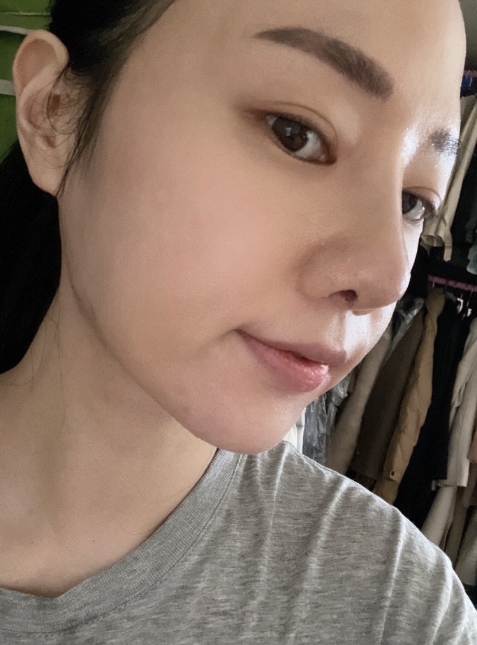 수술결과 200%만족중
